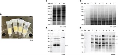 Production of the SARS-CoV-2 Spike protein and its Receptor Binding Domain in plant cell suspension cultures